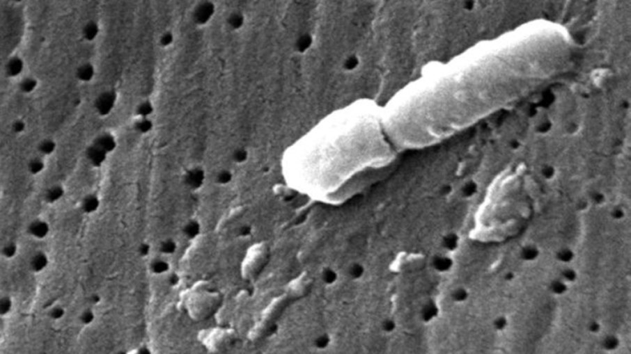 Bactéria Klebsiella pneumoniae Bactéria Klebsiella pneumoniae
