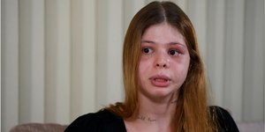 “Quase me mata no meu aniversário”, diz médica espancada