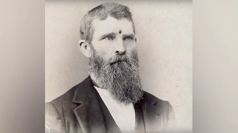 Jacob Miller se voluntariou para lutar pela União, levou um tiro na cabeça e viveu para contar sua história.