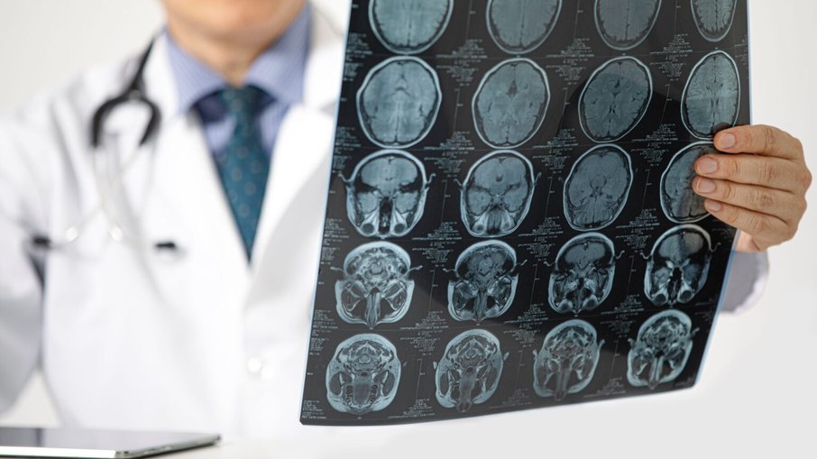 Estudos têm avançado em novos tratamentos e medicamentos Estudos têm avançado em novos tratamentos e medicamentos