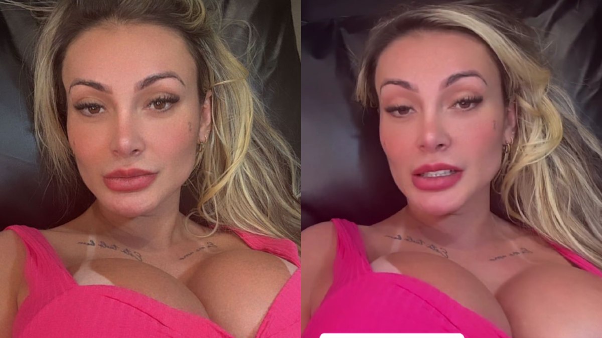 Andressa Urach gasta fortuna em procedimento inusitado no rosto: 'É a dor da beleza'