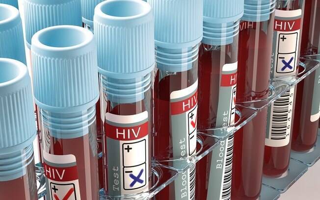 Oxford inicia testes de vacina contra o HIV