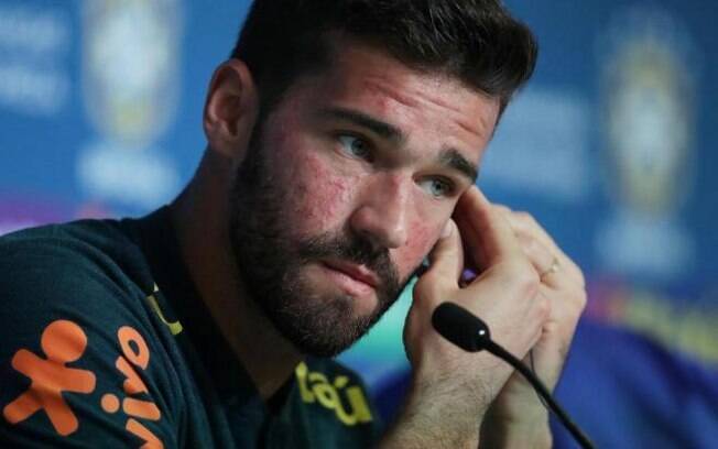 Rosto do goleiro Alisson, da Seleção, chamou atenção pela cor avermelhada, pápulas e pústulas, características da rosácea Rosto do goleiro Alisson, da Seleção, chamou atenção pela cor avermelhada, pápulas e pústulas, características da rosácea