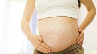 Estudo associa incontinência urinária a estrias adquiridas na gravidez