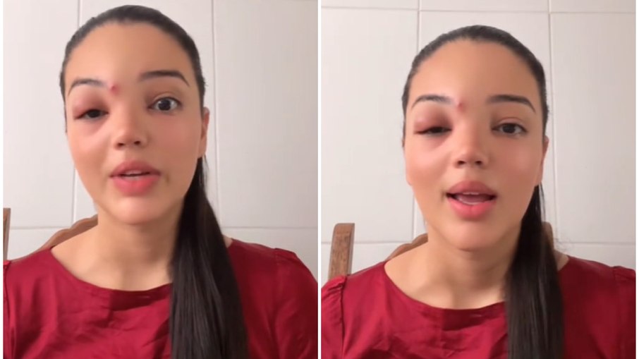 Jovem desenvolve celulite ocular após mexer em espinha.