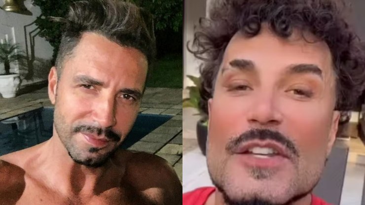 Latino choca ao aparecer com rosto todo harmonizado: "Nem parece"