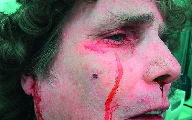 Ao chorar sangue, a mulher afirmou aos médicos, em 2003, que havia beliscado o nariz antes, ocasionando a lesão Ao chorar sangue, a mulher afirmou aos médicos, em 2003, que havia beliscado o nariz antes, ocasionando a lesão
