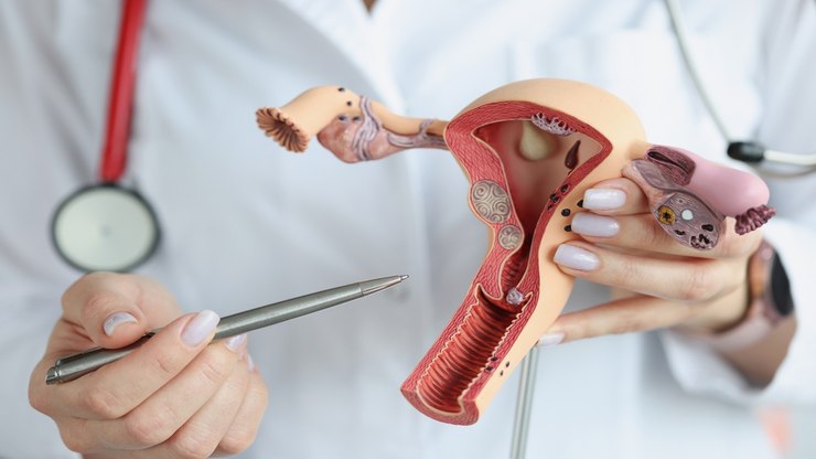 Câncer na vulva: descubra os sintomas silenciosos da doença