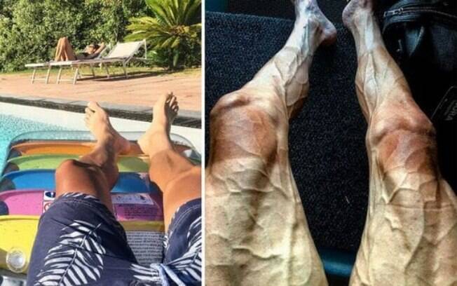 Ciclista Pawel Poljanski viralizou nas redes sociais com imagem impressionante de suas pernas após a Volta da França
