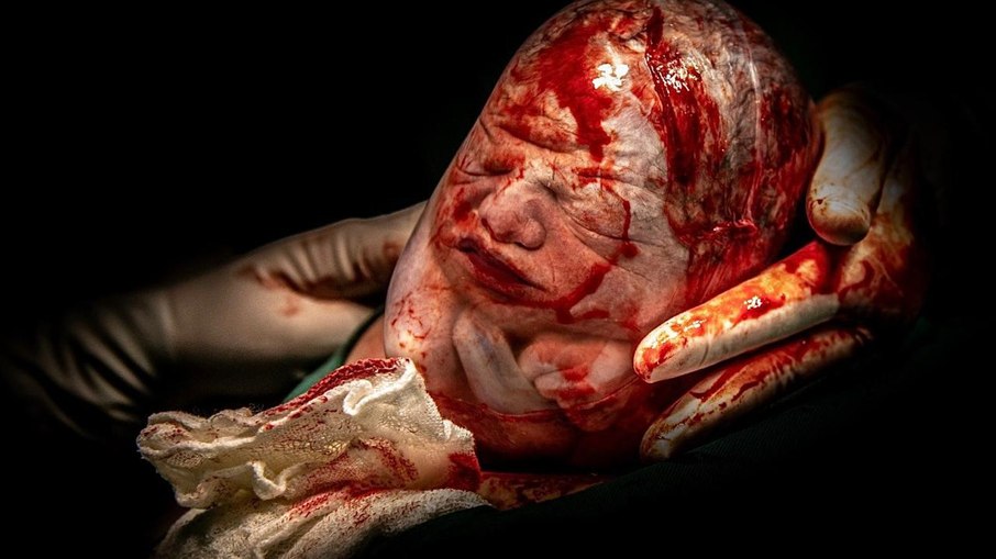 Maria Eliza, quarto bebê empelicado fotografado por Ludmila Gusman.