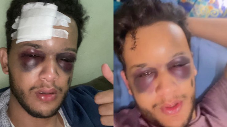 Cantor%20sofre%20traumatismo%20craniano%20ap%C3%B3s%20acidente%20em%20rodovia%20no%20MS
