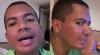 Ex-BBB Bruno Gaga faz harmonização facial e mostra resultado