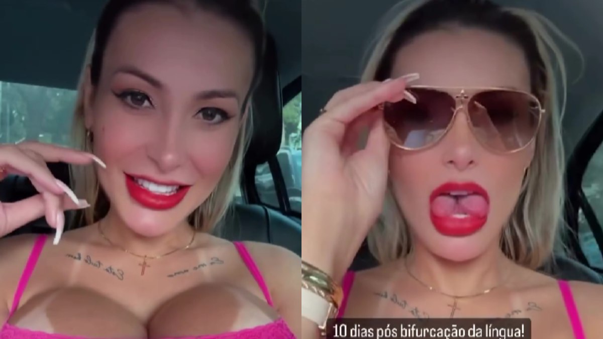 Andressa Urach expõe 'experiência' com o marido após bifurcação da língua