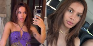 Mitos e verdades por trás do rejuvenescimento das famosas
