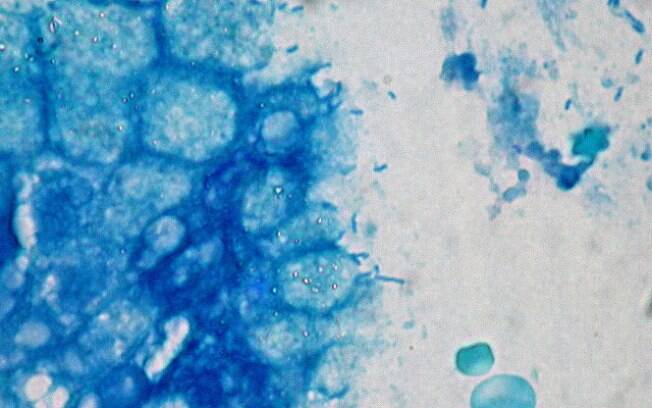 Bactéria estomacal H. Pylori. Foto: Wikimedia Commons