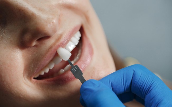 Falha em tratamento dentário nem sempre indica erro