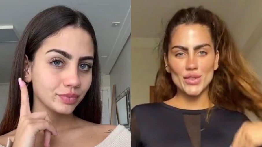 Catherine Bascoy surge irreconhecível após harmonização facial; veja o antes e depois