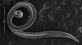 Mulher%20tem%20%22lombriga%20de%20olho%22%20e%20retira%20quatro%20vermes%20da%20p%C3%A1lpebra