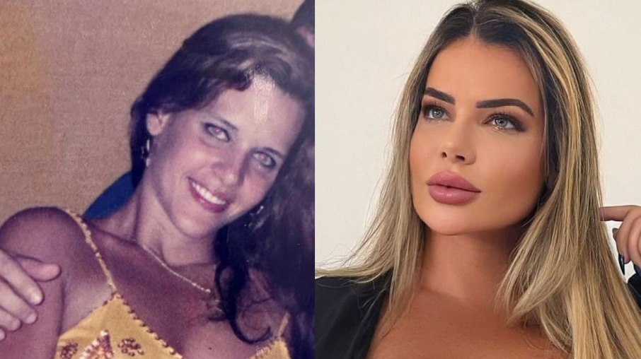 Denise Rocha choca com antes e depois