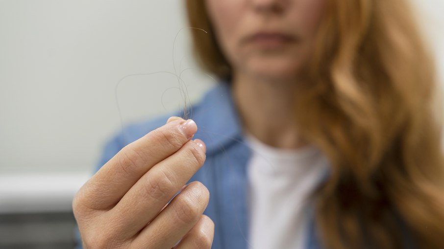 Queda de cabelo após canetas emagrecedoras preocupa mulheres Queda de cabelo após canetas emagrecedoras preocupa mulheres