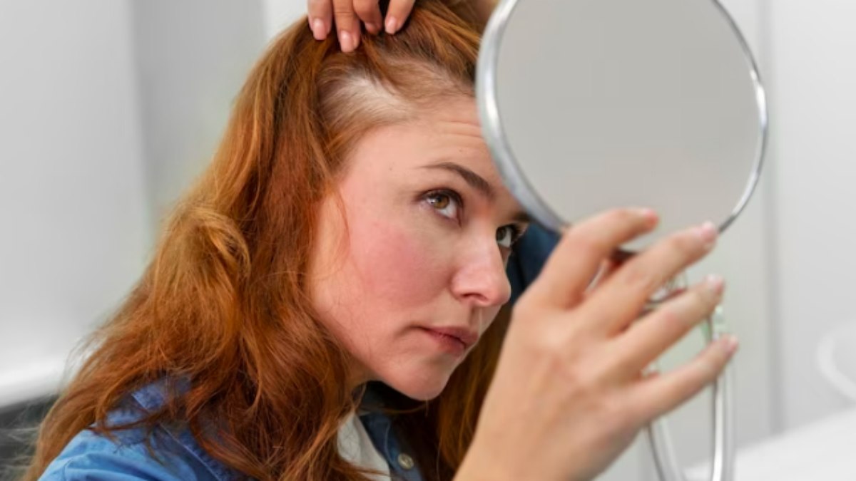 O que leva à queda de cabelo na menopausa?