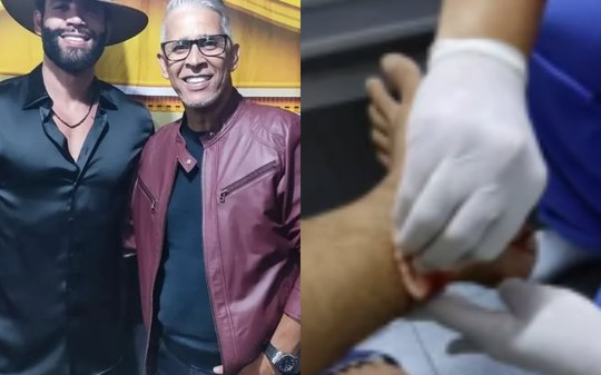 Irmão de Gusttavo Lima é atacado por macacos em Goiânia