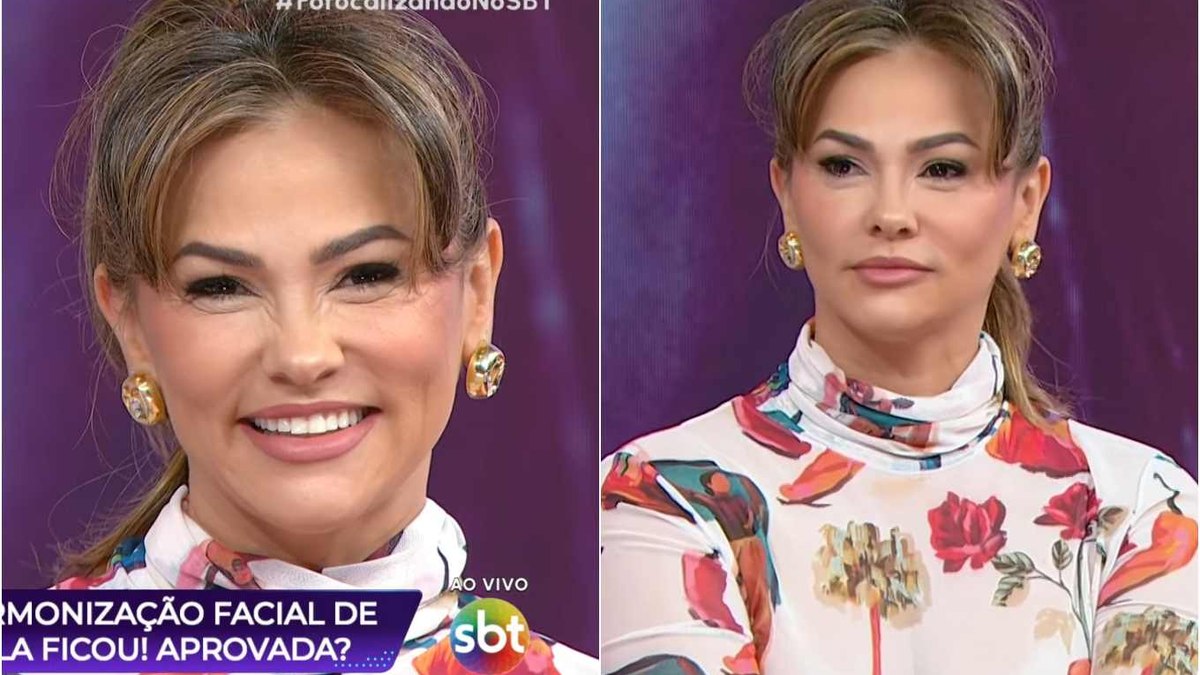 Ex-Tiazinha faz harmonização facial e revela novo visual ao vivo