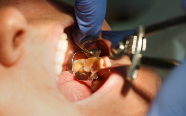 Dentista precisa acompanhar paciente durante o tratamento do câncer