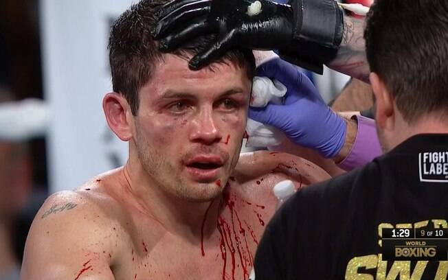 O boxeador inglês Stephen Smith foi castigado e derrotado pelo mexicano Francisco 