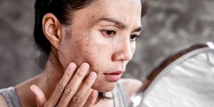 Sinais e manchas na pele: quando buscar avaliação médica?