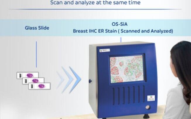 Scanner digital de lâminas de patologia equipado com inteligência artificial da OptraSCAN OS-SiA recebeu patente dos EUA para escaneamento, indexação e análise da área do tecido ao mesmo tempo