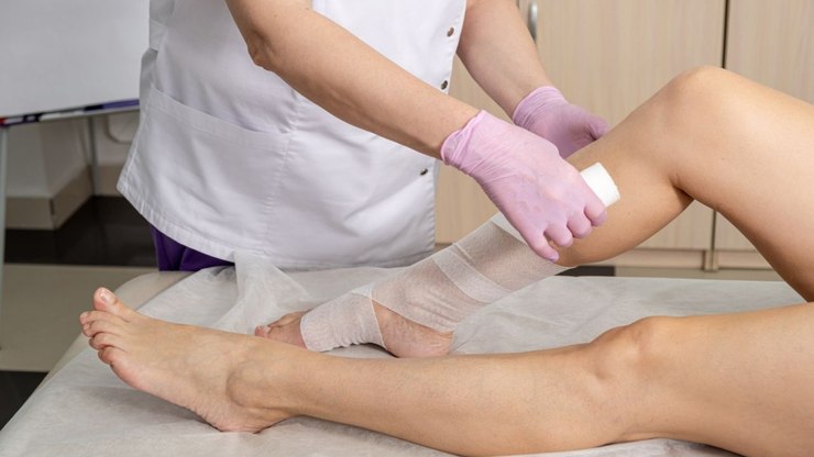 Lipoaspiração: novo estudo revela eficácia e segurança no tratamento do lipedema
