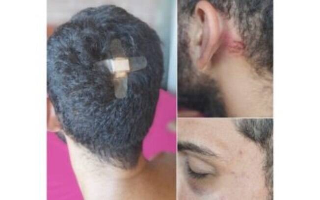 Caminhoneiro ficou com ferimentos após ser agredido por policiais à paisana no Rio de Janeiro