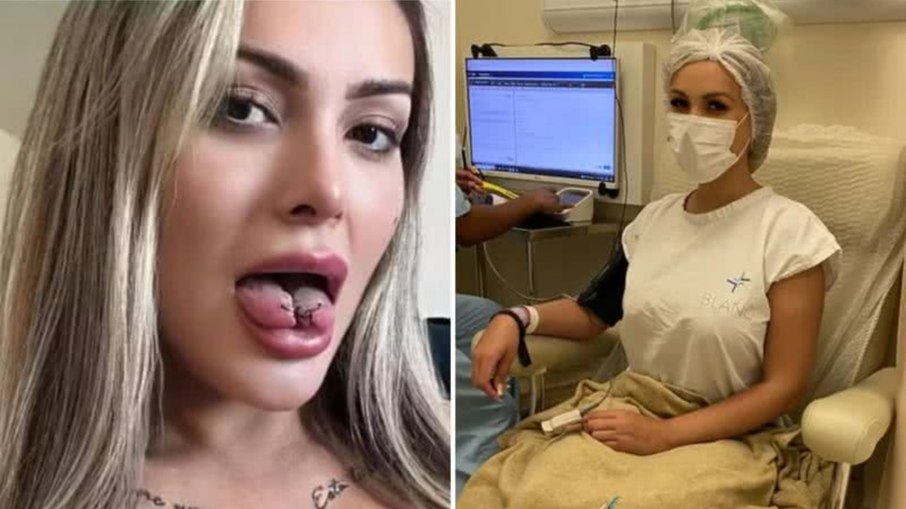 Procedimentos estéticos de Andressa Urach