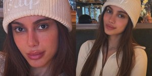 Rosto de Natal: Anitta surpreende ao exibir mais um novo visual