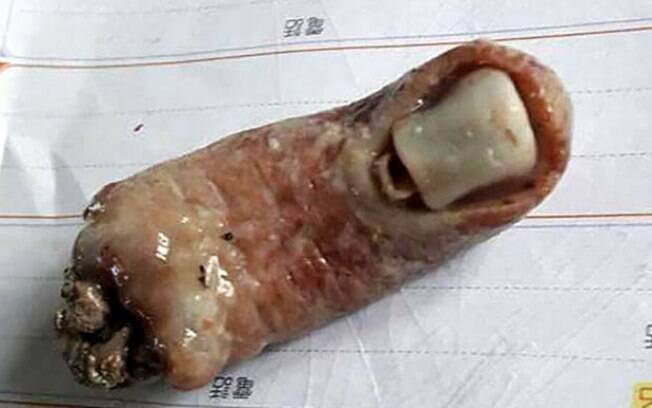 O órgão do peixe, chamado de bexiga natatória, se parece com um dedo humano e gerou dúvidas em Taiwan