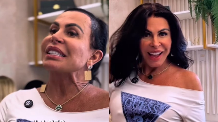 Gretchen fala sobre alopecia Gretchen fala sobre alopecia