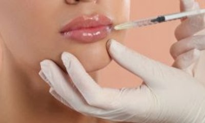Preenchimento labial tem reversão: saiba os melhores métodos