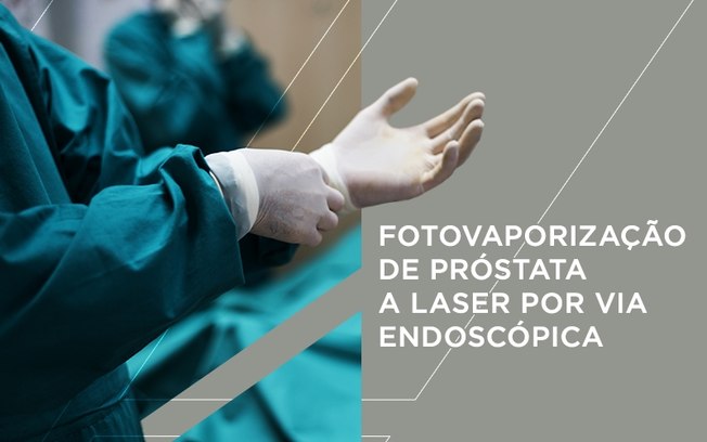 ANS aprova cobertura de Fotovaporização de próstata a laser