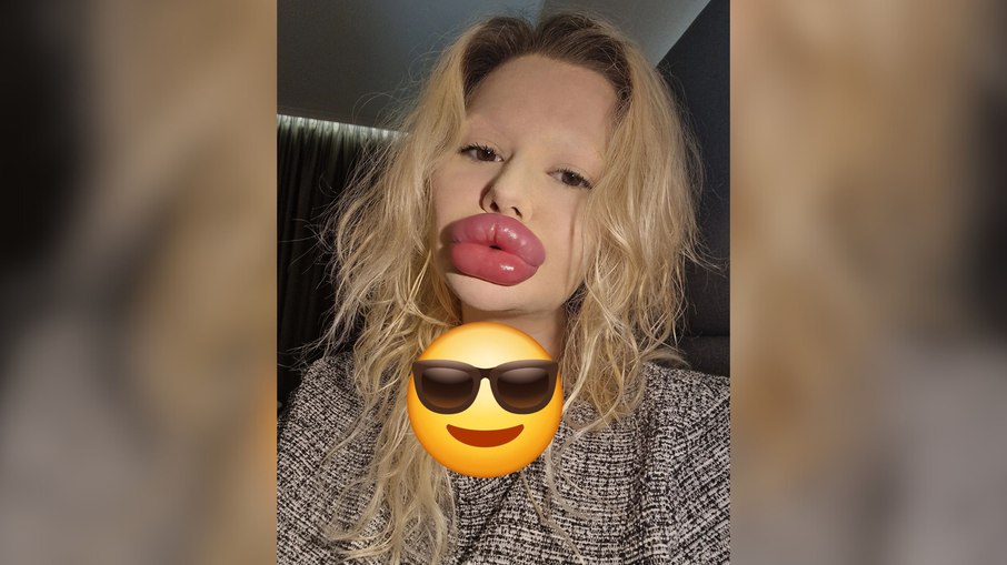 mulher dos maiores lábios mulher dos maiores lábios
