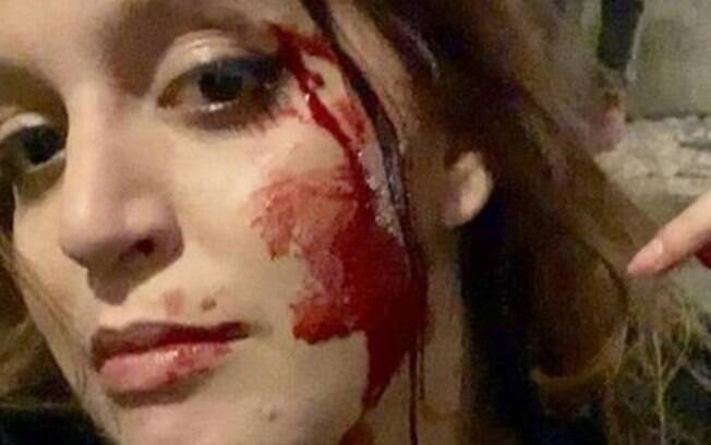 Estudante brasileira, Sophia Velho foi vítima de violência e xenofobia em Lisboa