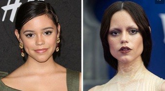 20%20celebridades%20que%20arruinaram%20seus%20rostos%20com%20bichectomia