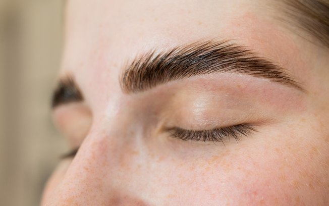 FUE Long Hair dá naturalidade ao transplante de sobrancelhas