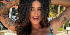 Ex-BBB Aline Campos realiza nova plástica no mesmo dia do lifting
