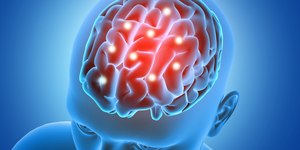 Epilepsia: o que causa a convulsão e como tratar?