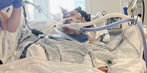 Adolescente morre após contrair rara “ameba comedora de cérebro”