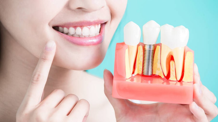 Reimplante dental: tratamento, resultados e cuidados pós-operatórios