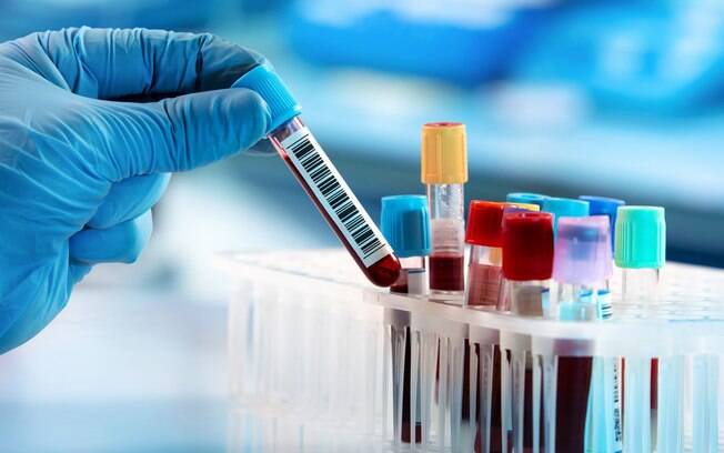 Casos de hepatite misteriosa surgem em mais de 20 países