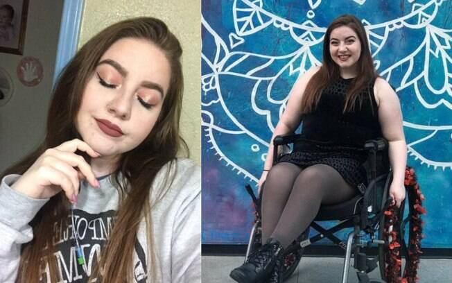 Em mais um caso de pessoas com deficiência, jovem relata algumas opiniões desrespeitosas por conta da cadeira de rodas