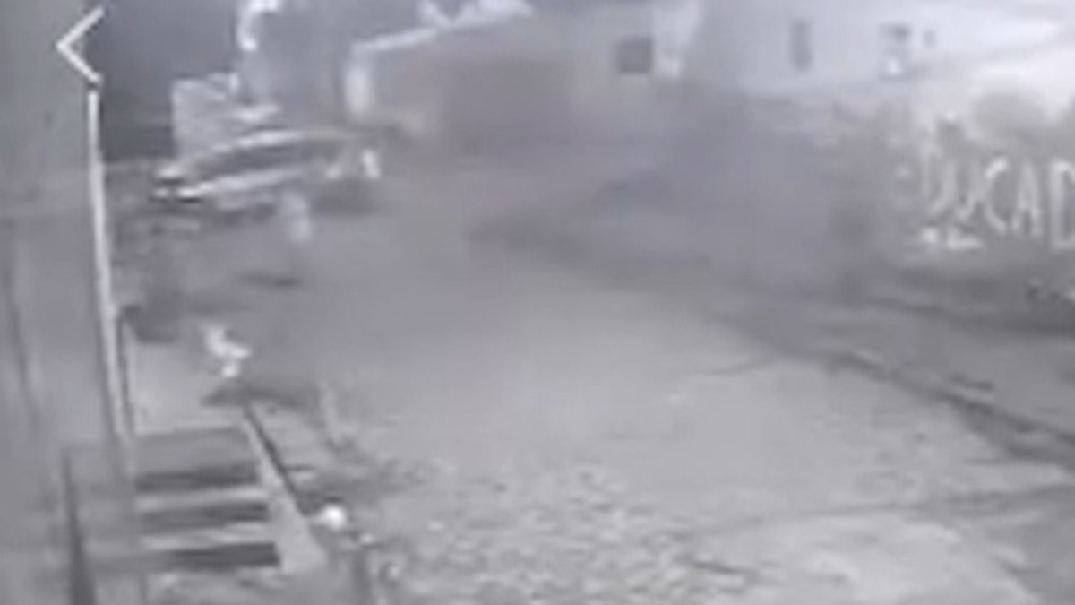 Criança atropelada por policial tem perna amputada em CG. Criança atropelada por policial tem perna amputada em CG.